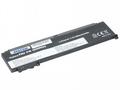 Baterie AVACOM pro Lenovo ThinkPad T460s Li-Pol 11