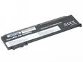 AVACOM Náhradní baterie Lenovo ThinkPad T460s Li-P