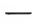 ASUS NTB ExpertBook B1 (B1503CVA-S70411XA), i3-100