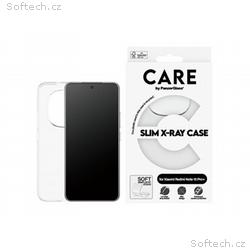 PG CARE Xiaomi Redmi Note 15 Pro+ X-Ray